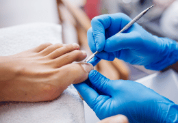 Uñas Encarnadas: Causas, Síntomas y Consejos para su Cuidado Uñas Encarnadas: Causas, Síntomas y Consejos para su Cuidado